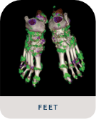 DECT scan of tophi from gout in foot